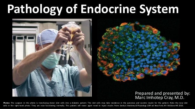 FREE USMLE Step 1 Exam In Your Hands : PART FIVE: ENDOCRINE SYSTEM